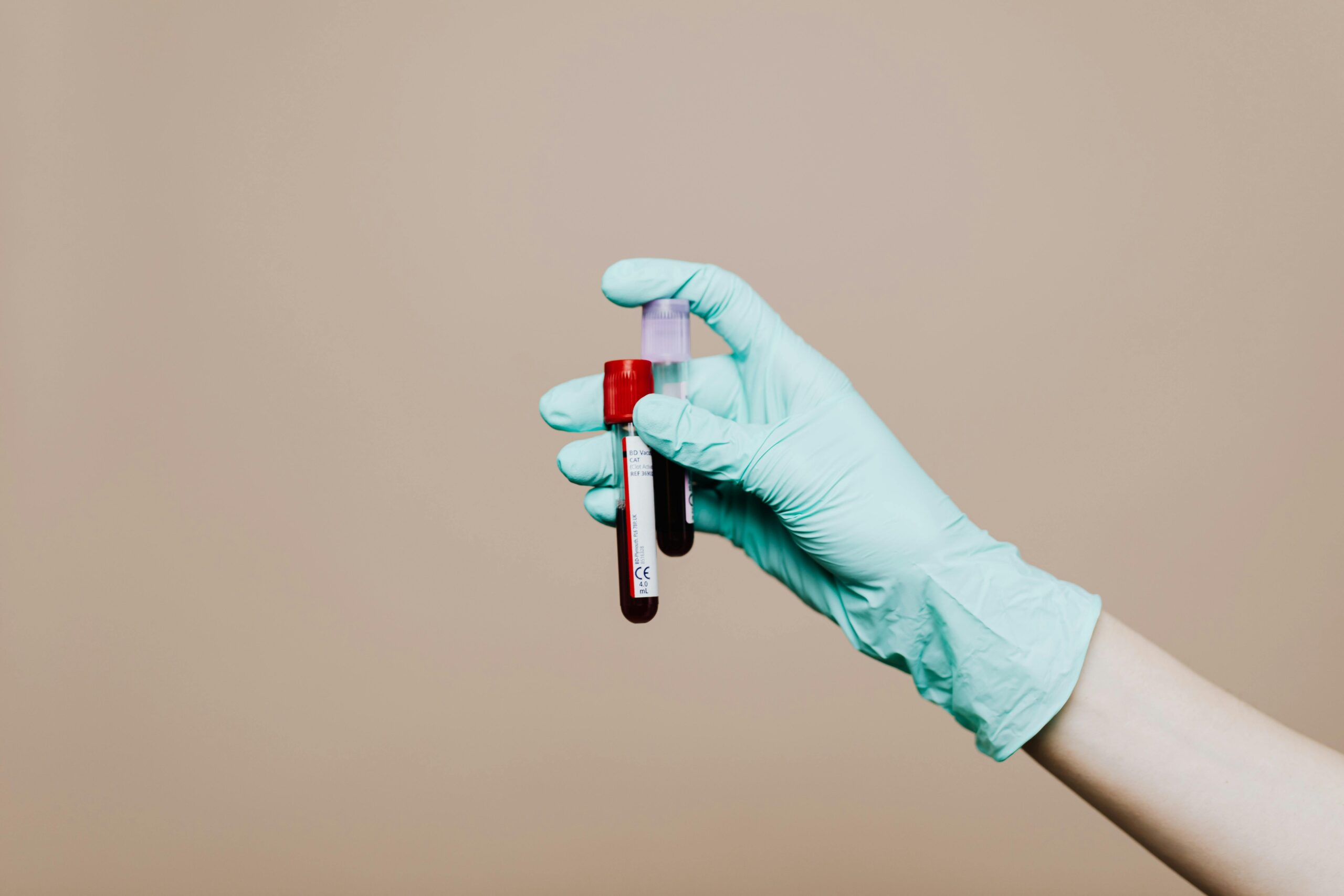a gloved hand holds two full test tubes full of blood samples